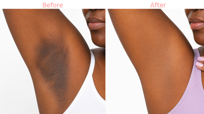 Kerature™ Dark Spot Correcting Oil